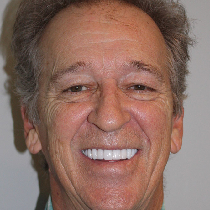Cosmetic Dentistry for a Radiant Look - After